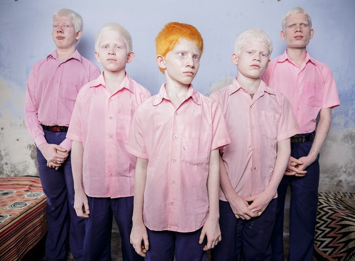 Rapazes albinos cegos - Escola para cegos em Bengala, Índia - foto Brent Stirton, 2013